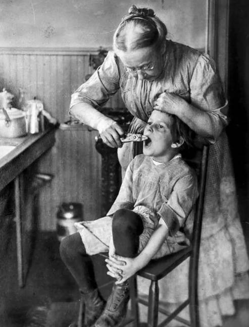 Tooth Extraction